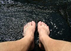 Jak przygotować się do usunięcia haluksa?